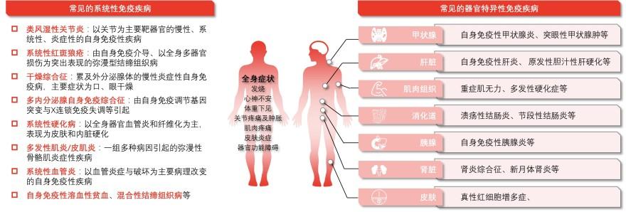 特色图表