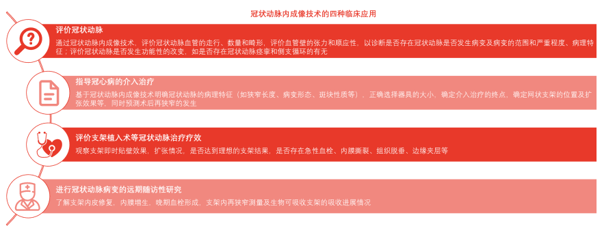 特色图表