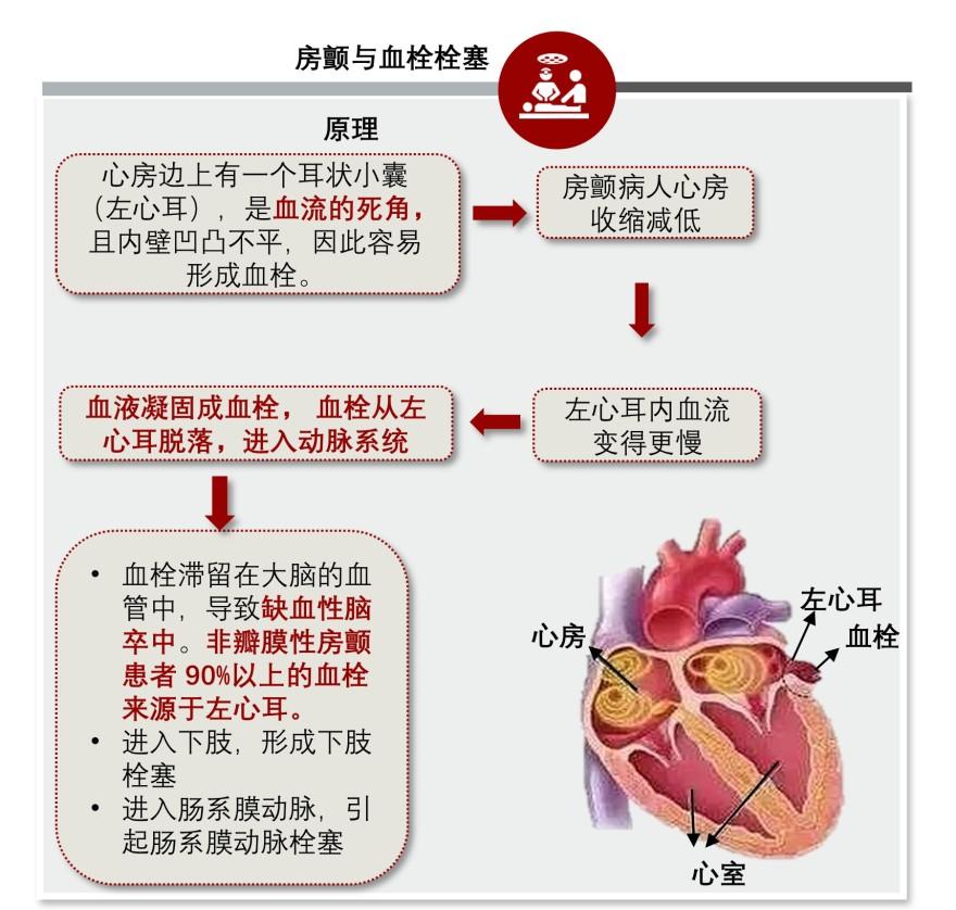 特色图表