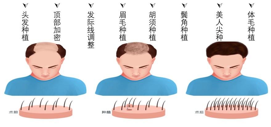 特色图表