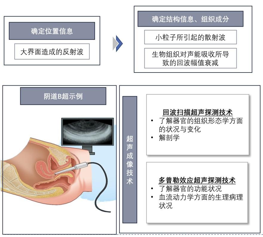 特色图表