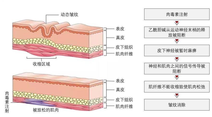 特色图表