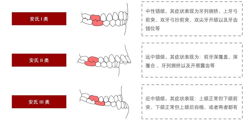 特色图表