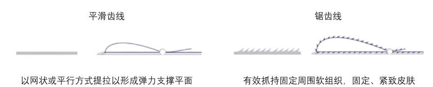 特色图表