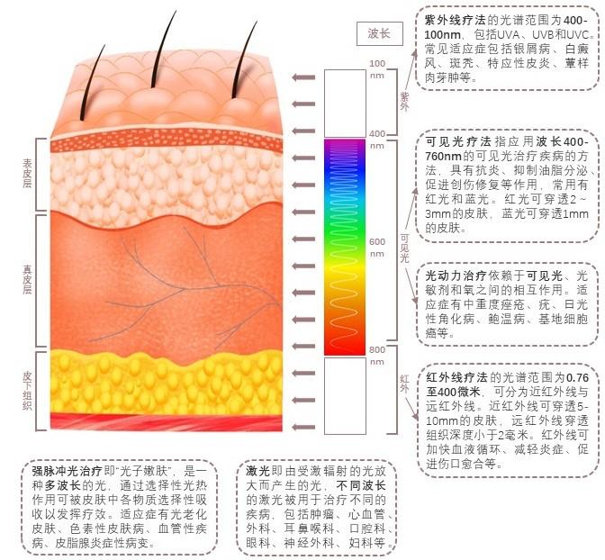 特色图表